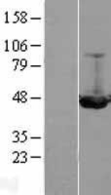 Western Blot: ILKAP Overexpression Lysate (Adult Normal) [NBL1-11976] Left-Empty vector transfected control cell lysate (HEK293 cell lysate); Right -Over-expression Lysate for ILKAP.
