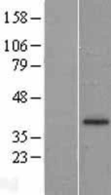 Western Blot: Langerin Overexpression Lysate (Adult Normal) [NBL1-08920] Left-Empty vector transfected control cell lysate (HEK293 cell lysate); Right -Over-expression Lysate for Langerin.