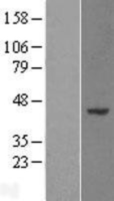 Western Blot: WDR89 Overexpression Lysate (Adult Normal) [NBL1-17834] Left-Empty vector transfected control cell lysate (HEK293 cell lysate); Right -Over-expression Lysate for WDR89.