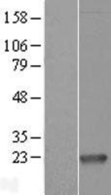 Western Blot: Proapoptotic Caspase Adaptor Protein Overexpression Lysate (Adult Normal) [NBL1-13064] Left-Empty vector transfected control cell lysate (HEK293 cell lysate); Right -Over-expression Lysate for Proapoptotic Caspase Adaptor Protein.
