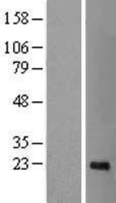 Western Blot: CDCA4 Overexpression Lysate (Adult Normal) [NBL1-09018] Left-Empty vector transfected control cell lysate (HEK293 cell lysate); Right -Over-expression Lysate for CDCA4.