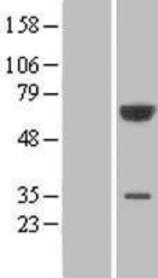 Western Blot: PGM3 Overexpression Lysate (Adult Normal) [NBL1-14340] Left-Empty vector transfected control cell lysate (HEK293 cell lysate); Right -Over-expression Lysate for PGM3.