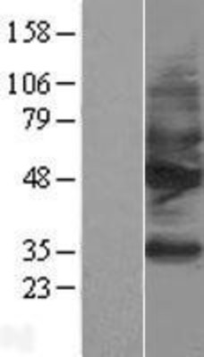 Western Blot: Somatostatin Receptor 2 Overexpression Lysate (Adult Normal) [NBL1-16478] Left-Empty vector transfected control cell lysate (HEK293 cell lysate); Right -Over-expression Lysate for Somatostatin Receptor 2.