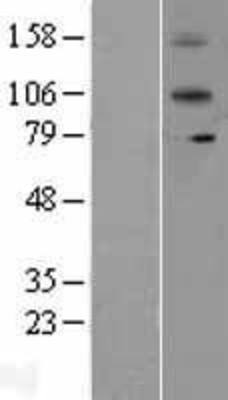 Western Blot: IL12RB2 Overexpression Lysate (Adult Normal) [NBL1-11903] Left-Empty vector transfected control cell lysate (HEK293 cell lysate); Right -Over-expression Lysate for IL12RB2.