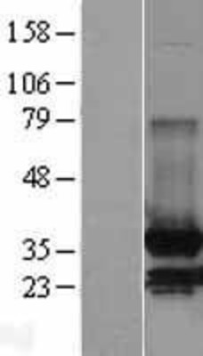 Western Blot: MDH2 Overexpression Lysate (Adult Normal) [NBL1-12966] Left-Empty vector transfected control cell lysate (HEK293 cell lysate); Right -Over-expression Lysate for MDH2.