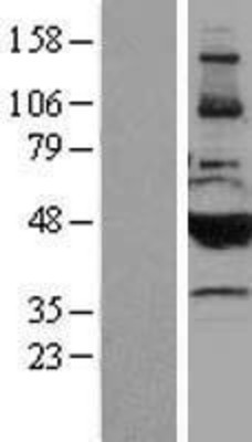 Western Blot: Cytochrome P450 2B6 Overexpression Lysate (Adult Normal) [NBP2-04177] Left-Empty vector transfected control cell lysate (HEK293 cell lysate); Right -Over-expression Lysate for Cytochrome P450 2B6.