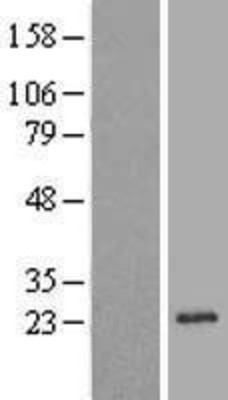 Western Blot: REEP1 Overexpression Lysate (Adult Normal) [NBL1-15266] Left-Empty vector transfected control cell lysate (HEK293 cell lysate); Right -Over-expression Lysate for REEP1.