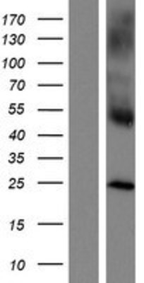 Western Blot: CLEC4A Overexpression Lysate (Adult Normal) [NBP2-04351] Left-Empty vector transfected control cell lysate (HEK293 cell lysate); Right -Over-expression Lysate for CLEC4A.