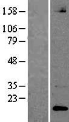Western Blot: Neuroligin 1 Overexpression Lysate (Adult Normal) [NBP2-04347] Left-Empty vector transfected control cell lysate (HEK293 cell lysate); Right -Over-expression Lysate for Neuroligin 1.