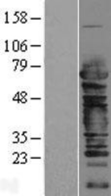 Western Blot: Cleavage stimulation factor 2 Overexpression Lysate (Adult Normal) [NBP2-04195] Left-Empty vector transfected control cell lysate (HEK293 cell lysate); Right -Over-expression Lysate for Cleavage stimulation factor 2.