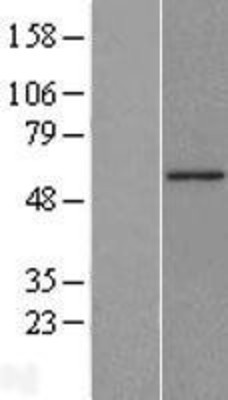 Western Blot: FLIP Overexpression Lysate (Adult Normal) [NBL1-09128] Left-Empty vector transfected control cell lysate (HEK293 cell lysate); Right -Over-expression Lysate for FLIP.
