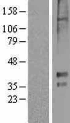 Western Blot: 5HT1E Receptor Overexpression Lysate (Adult Normal) [NBL1-11777] Left-Empty vector transfected control cell lysate (HEK293 cell lysate); Right -Over-expression Lysate for 5HT1E Receptor.