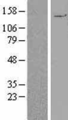 Western Blot: PALB2 Overexpression Lysate (Adult Normal) [NBL1-14086] Left-Empty vector transfected control cell lysate (HEK293 cell lysate); Right -Over-expression Lysate for PALB2.