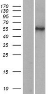 Western Blot: HYAL2 Overexpression Lysate (Adult Normal) [NBP2-04257] Left-Empty vector transfected control cell lysate (HEK293 cell lysate); Right -Over-expression Lysate for HYAL2.