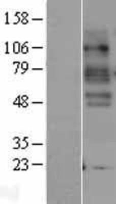 Western Blot: Serotonin transporter Overexpression Lysate (Adult Normal) [NBP2-04189] Left-Empty vector transfected control cell lysate (HEK293 cell lysate); Right -Over-expression Lysate for Serotonin transporter.