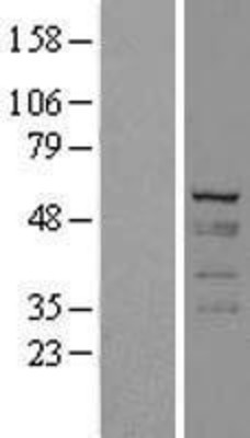 Western Blot: Cytokeratin 7 Overexpression Lysate (Adult Normal) [NBL1-12396] Left-Empty vector transfected control cell lysate (HEK293 cell lysate); Right -Over-expression Lysate for Cytokeratin 7.