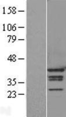 Western Blot: hnRNP A1 Overexpression Lysate (Adult Normal) [NBL1-11635] Left-Empty vector transfected control cell lysate (HEK293 cell lysate); Right -Over-expression Lysate for hnRNP A1.