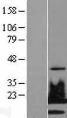 Western Blot: gamma H2AX Overexpression Lysate (Adult Normal) [NBL1-11424] Left-Empty vector transfected control cell lysate (HEK293 cell lysate); Right -Over-expression Lysate for gamma H2AX.