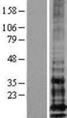 Western Blot: IFITM1 Overexpression Lysate (Adult Normal) [NBL1-11839] Left-Empty vector transfected control cell lysate (HEK293 cell lysate); Right -Over-expression Lysate for IFITM1.