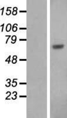 Western Blot: Human Serum Albumin Overexpression Lysate (Adult Normal) [NBL1-07449] Left-Empty vector transfected control cell lysate (HEK293 cell lysate); Right -Over-expression Lysate for Human Serum Albumin.