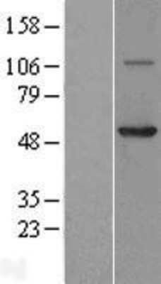Western Blot: Coronin 3 Overexpression Lysate (Adult Normal) [NBL1-09398] Left-Empty vector transfected control cell lysate (HEK293 cell lysate); Right -Over-expression Lysate for Coronin 3.