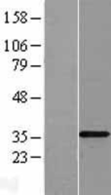 Western Blot: TLX3 Overexpression Lysate (Adult Normal) [NBL1-16958] Left-Empty vector transfected control cell lysate (HEK293 cell lysate); Right -Over-expression Lysate for TLX3.