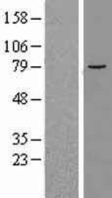 Western Blot: ALOX12B Overexpression Lysate (Adult Normal) [NBL1-07480] Left-Empty vector transfected control cell lysate (HEK293 cell lysate); Right -Over-expression Lysate for ALOX12B.