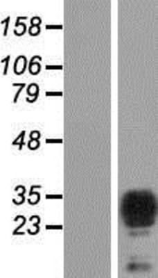 Western Blot: TPD52L2/D54 Overexpression Lysate (Adult Normal) [NBP2-04612] Left-Empty vector transfected control cell lysate (HEK293 cell lysate); Right -Over-expression Lysate for TPD52L2/D54.
