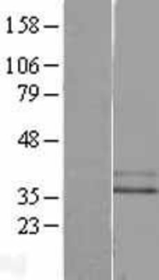 Western Blot: MRGX2 Overexpression Lysate (Adult Normal) [NBL1-13226] Left-Empty vector transfected control cell lysate (HEK293 cell lysate); Right -Over-expression Lysate for MRGX2.