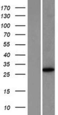 Western Blot: NANOS1 Overexpression Lysate (Adult Normal) [NBP2-04615] Left-Empty vector transfected control cell lysate (HEK293 cell lysate); Right -Over-expression Lysate for NANOS1.