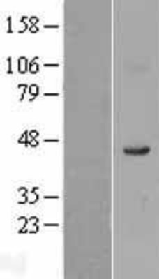 Western Blot: FADS1 Overexpression Lysate (Adult Normal) [NBL1-10425] Left-Empty vector transfected control cell lysate (HEK293 cell lysate); Right -Over-expression Lysate for FADS1.