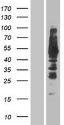 Western Blot: THEM4 Overexpression Lysate (Adult Normal) [NBP2-04410] Left-Empty vector transfected control cell lysate (HEK293 cell lysate); Right -Over-expression Lysate for THEM4.