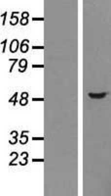 Western Blot: Choline kinase alpha Overexpression Lysate (Adult Normal) [NBP2-04484] Left-Empty vector transfected control cell lysate (HEK293 cell lysate); Right -Over-expression Lysate for Choline kinase alpha.