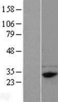 Western Blot: FAM78B Overexpression Lysate (Adult Normal) [NBL1-10567] Left-Empty vector transfected control cell lysate (HEK293 cell lysate); Right -Over-expression Lysate for FAM78B.