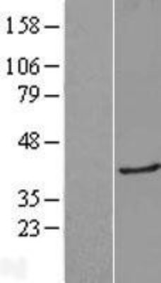 Western Blot: Galectin 8 Overexpression Lysate (Adult Normal) [NBP2-04592] Left-Empty vector transfected control cell lysate (HEK293 cell lysate); Right -Over-expression Lysate for Galectin 8.
