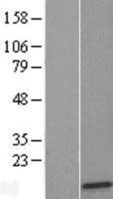 Western Blot: RPL36 Overexpression Lysate (Adult Normal) [NBL1-15532] Left-Empty vector transfected control cell lysate (HEK293 cell lysate); Right -Over-expression Lysate for RPL36.