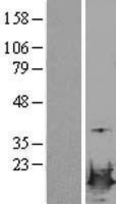 Western Blot: LSM4 Overexpression Lysate (Adult Normal) [NBL1-12727] Left-Empty vector transfected control cell lysate (HEK293 cell lysate); Right -Over-expression Lysate for LSM4.
