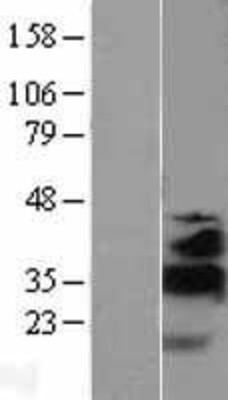 Western Blot: KLF13 Overexpression Lysate (Adult Normal) [NBL1-12316] Left-Empty vector transfected control cell lysate (HEK293 cell lysate); Right -Over-expression Lysate for KLF13.