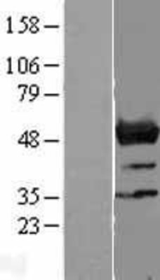 Western Blot: NLE1 Overexpression Lysate (Adult Normal) [NBL1-13664] Left-Empty vector transfected control cell lysate (HEK293 cell lysate); Right -Over-expression Lysate for NLE1.