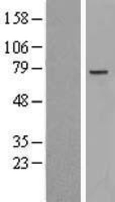 Western Blot: NCAPH2 Overexpression Lysate (Adult Normal) [NBL1-13506] Left-Empty vector transfected control cell lysate (HEK293 cell lysate); Right -Over-expression Lysate for NCAPH2.