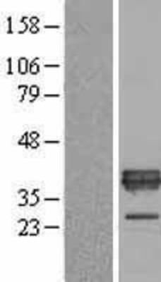 Western Blot: ApoE Overexpression Lysate (Adult Normal) [NBL1-07621] Left-Empty vector transfected control cell lysate (HEK293 cell lysate); Right -Over-expression Lysate for ApoE.