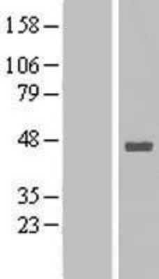 Western Blot: Stomatin-like protein 1 Overexpression Lysate (Adult Normal) [NBL1-16562] Left-Empty vector transfected control cell lysate (HEK293 cell lysate); Right -Over-expression Lysate for Stomatin-like protein 1.