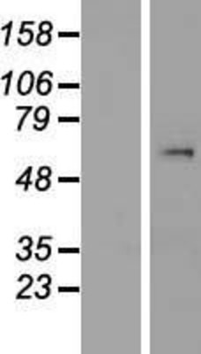 Western Blot: SmyD1 Overexpression Lysate (Adult Normal) [NBP2-04716] Left-Empty vector transfected control cell lysate (HEK293 cell lysate); Right -Over-expression Lysate for SmyD1.