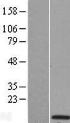Western Blot: KCTD4 Overexpression Lysate (Adult Normal) [NBP2-04735] Left-Empty vector transfected control cell lysate (HEK293 cell lysate); Right -Over-expression Lysate for KCTD4.