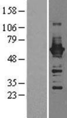 Western Blot: CaMKIV Overexpression Lysate (Adult Normal) [NBL1-08666] Left-Empty vector transfected control cell lysate (HEK293 cell lysate); Right -Over-expression Lysate for CaMKIV.