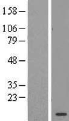 Western Blot: C11orf67 Overexpression Lysate (Adult Normal) [NBL1-08115] Left-Empty vector transfected control cell lysate (HEK293 cell lysate); Right -Over-expression Lysate for C11orf67.