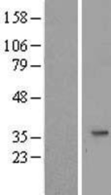Western Blot: SLC25A20 Overexpression Lysate (Adult Normal) [NBL1-16054] Left-Empty vector transfected control cell lysate (HEK293 cell lysate); Right -Over-expression Lysate for SLC25A20.