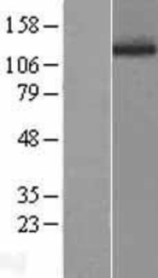 Western Blot: Phospholipase D1 Overexpression Lysate (Adult Normal) [NBL1-14494] Left-Empty vector transfected control cell lysate (HEK293 cell lysate); Right -Over-expression Lysate for Phospholipase D1.