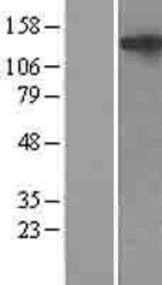 Western Blot: NLRP5 Overexpression Lysate (Adult Normal) [NBL1-13676] Left-Empty vector transfected control cell lysate (HEK293 cell lysate); Right -Over-expression Lysate for NLRP5.