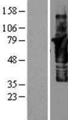 Western Blot: Cortactin Overexpression Lysate (Adult Normal) [NBP2-04417] Left-Empty vector transfected control cell lysate (HEK293 cell lysate); Right -Over-expression Lysate for Cortactin.